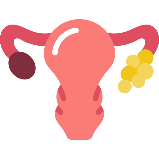 PCOS (Polycystic Ovary Syndrome)
